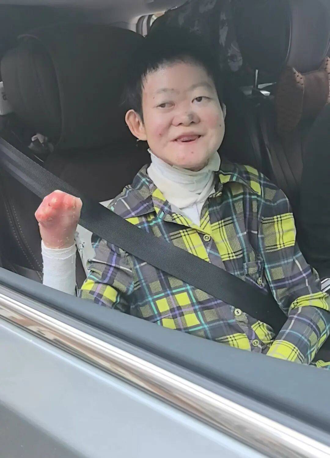 醫(yī)生斷言“活不過2歲”的鄭州罕見病女孩，24歲“帶傷出征”，開啟西藏之行:機械制造